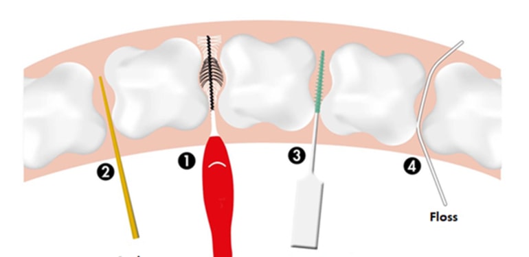 Deze afbeelding laat 4 verschillende materialen zien waarmee je tussen de tanden en kiezen kunt reinigen. Van links naar rechts is als eerste een stoker te zien, dan een rager, vervolgens een softpick en als laatste floss. 