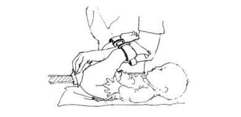Een tekening van een enkelbandje om babybeentjes omhoog te houden voor verschonen met één hand. 